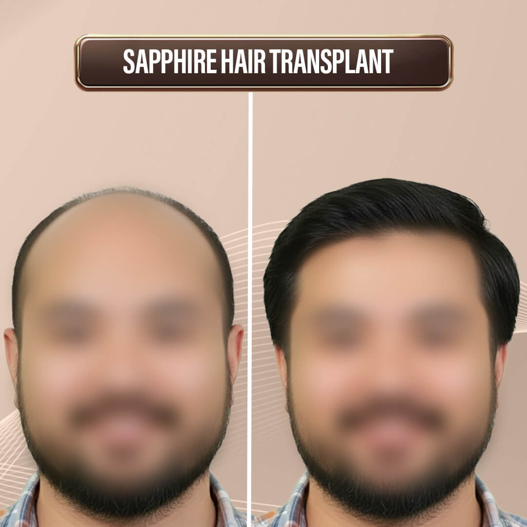 Max Singapore WebsiteArtboard 1 copy 13