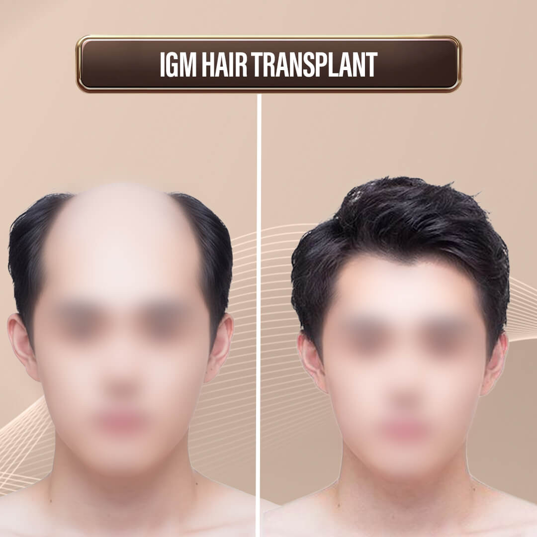 Max Singapore WebsiteArtboard 1 copy 14