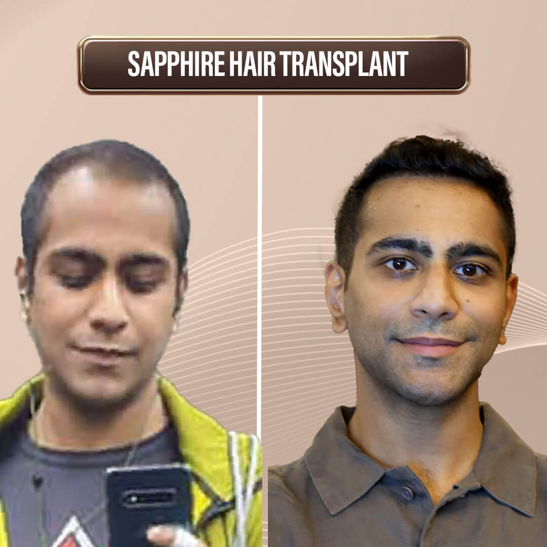 Max Singapore WebsiteArtboard 1 copy 5