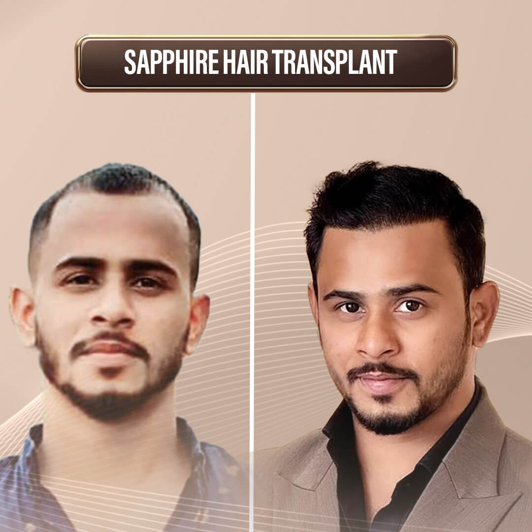 Max Singapore WebsiteArtboard 1 copy 6