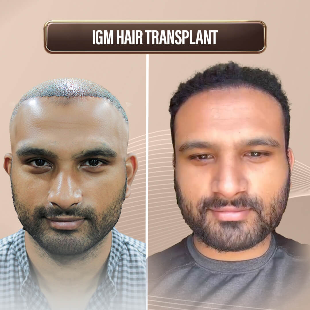 Max Singapore WebsiteArtboard 1 copy 7