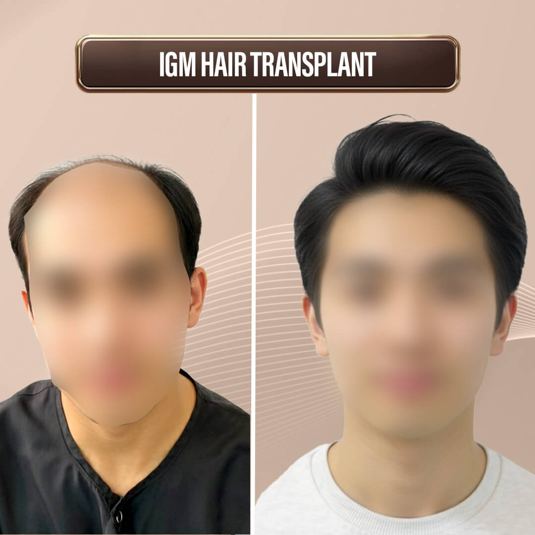 Max Singapore WebsiteArtboard 1 copy 9